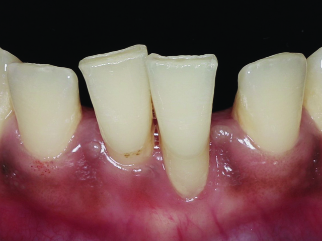 The Synergy of Periodontic and Orthodontic Collaboration in Contemporary Oral Health Practice
