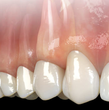 New Directions in Endodontics