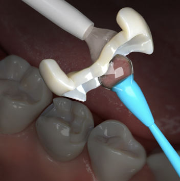 Restorative Dentistry Pathways