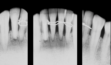 Diagnosis and Nonsurgical Treatment of Periodontitis: Pragmatic Utilization of Contemporary Knowledge