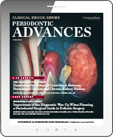 Periodontic Advances Ebook Cover