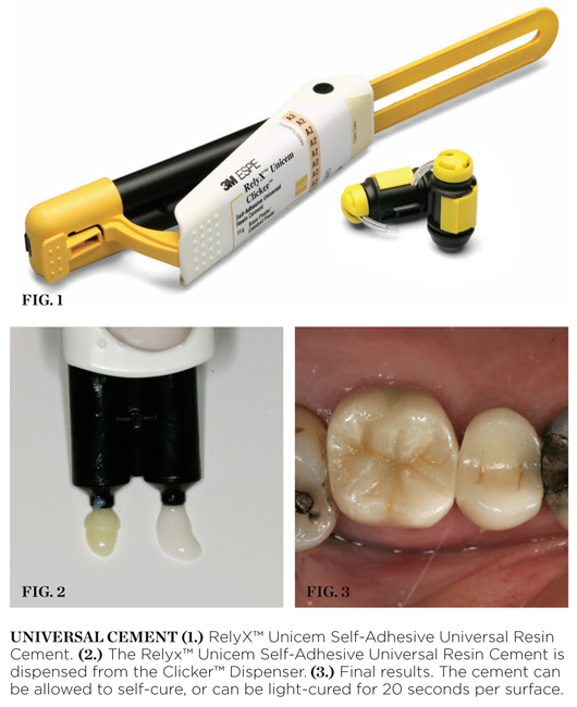 Ultimate Dental  3M Relyx Unicem