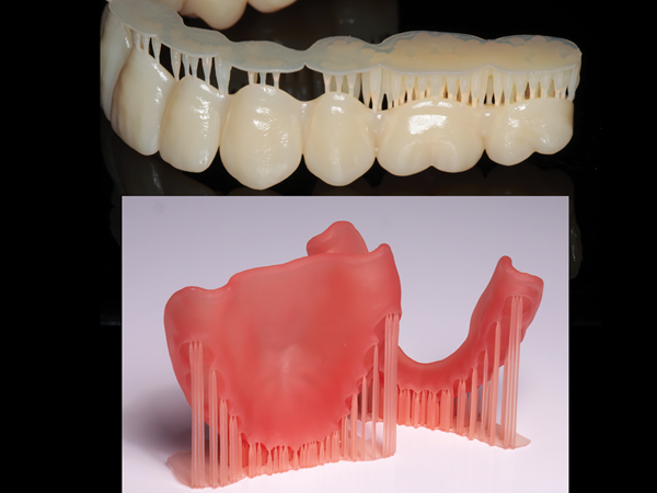 Distinct Digital Dentures | October 2020 | Inside Dental Technology