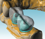 Fig 3. Atlantis BridgeBase digital design.