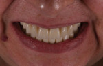 (28.) Posttreatment smile photograph.