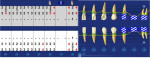 Fig 10. Periodontal charting of the mandibular left quadrant at the 8-month recall evaluation demonstrating stable probing on teeth Nos. 18 and 20 and elimination of the mobility initially present on No. 18.