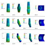 Fig 2. FEA images indicating von Mises stresses for internal conical implant–abutment connection on (a) implant, (b) abutment, (c) implant–abutment connection, and (d) cortical bone as 1A, 1B, and 1C, where A = 0 degrees, B = 17 degrees, and C = 25 degrees.