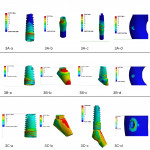 Fig 4. FEA images indicating von Mises stresses for internal hex implant–abutment connection on (a) implant, (b) abutment, (c) implant–abutment connection, and (d) cortical bone as 3A, 3B, and 3C, where A = 0 degrees, B = 15 degrees, and C = 25 degrees.