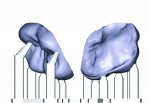 (8.) View of the final design of the occlusal veneers with build supports for 3D printing.