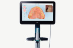 Align Technology iTero Lumina™ scanner