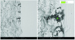 (6.) Circumferential particles (5 to 30 μm) of fluorocarbon-based polymer at the titanium implant shoulder shown at SEM 500× (left) and 2,500× (right).