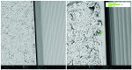 (7.) Numerous organic (carbonaceous) contaminants (5 to 15 μm) circulating the titanium implant shoulder shown at SEM 500× (left) and 2,500× (right).