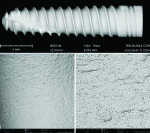 (10.) SEM mapping image of a whole titanium implant (Spiral SB/LA, Ritter Implants) following removal from the manufacturer’s packaging (top) as well as SEM 500× (left) and 2,500× (right) close-up views demonstrating a clean surface free of any organic or metallic particles or other debris.