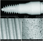 (11.) SEM mapping image of a whole ceramic implant (SDS2.2, Swiss Dental Solutions) following removal from the manufacturer’s packaging (top) as well as SEM 500× (left) and 2,500× (right) close-up views demonstrating a clean surface free of any organic or metallic particles or other debris. Note that the black dots in the higher magnification view are part of the implant’s core ceramic material.