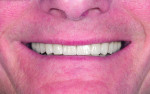 Fig. 17: Final smile photograph.