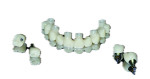 (21.) View of the final maxillary FP1-style coping-free milled monolithic zirconia restoration
along with the final individual mandibular crowns.