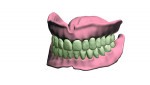 3Shape’s Denture Design