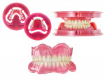 Baltic Denture System®