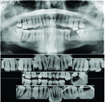 (6.) Preoperative panoramic and periapical
radiographs.