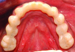 (19.)  Four-year postoperative follow-up photographs, including maxillary and mandibular occlusal views, retracted right and left lateral views, a retracted frontal view, and a smile photograph, respectively.