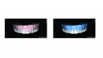 Fig 4. Facially driven 3D diagnostic
wax-up done by the smile design planning center: left, ideal pretreatment
(original model untouched); right, ideal post-treatment (original
model digitally reduced on subtractive areas).