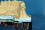 Figure 1   Soft view, soft tissue markings reveal bone volume.