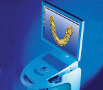 Figure 4 The CEREC 3 system.